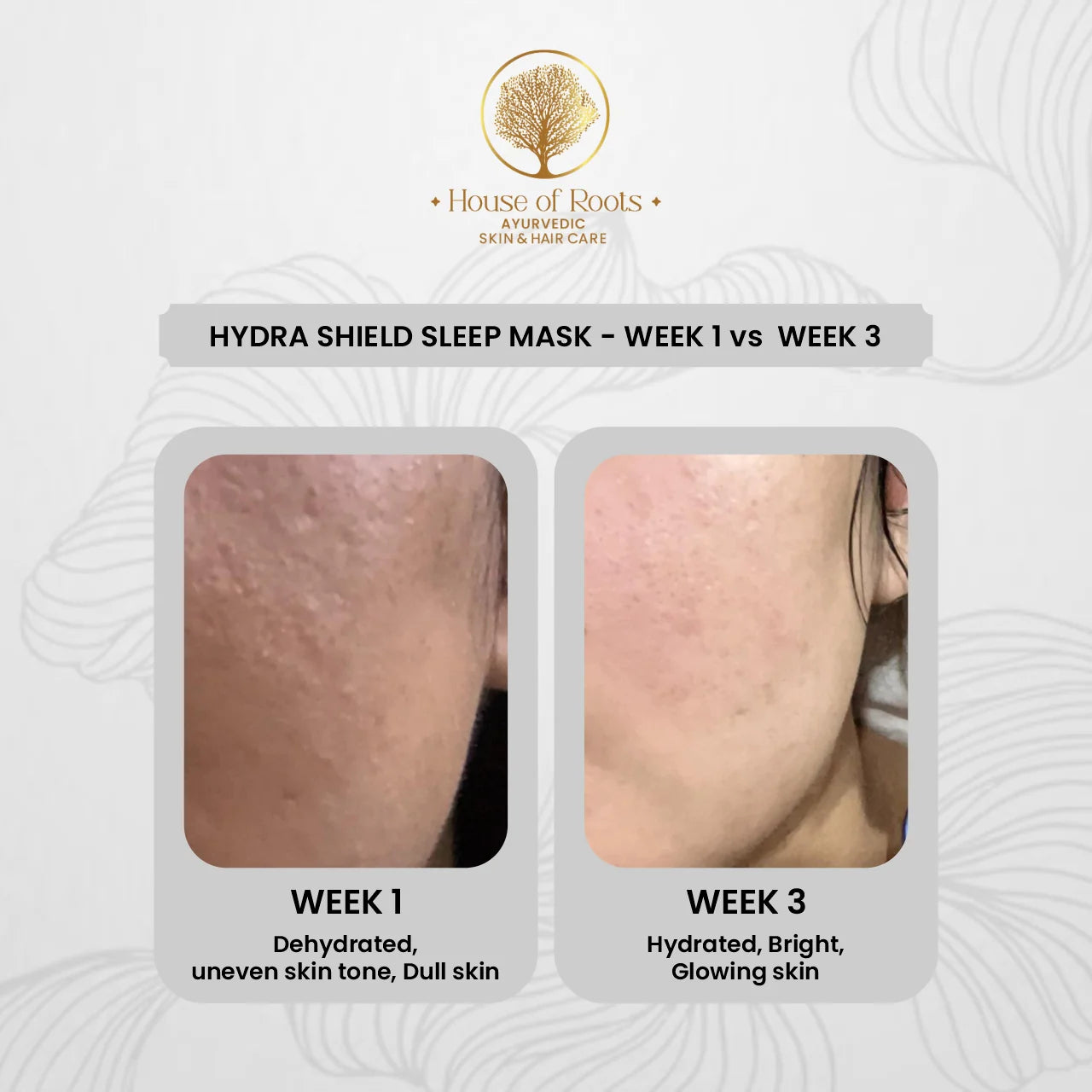 Hydra Shield Sleep Mask